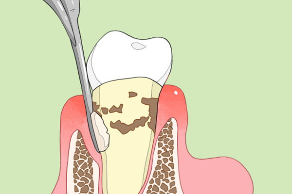 ����ȣ����ô�� ���Ԥ��ȣ�ݵķ���